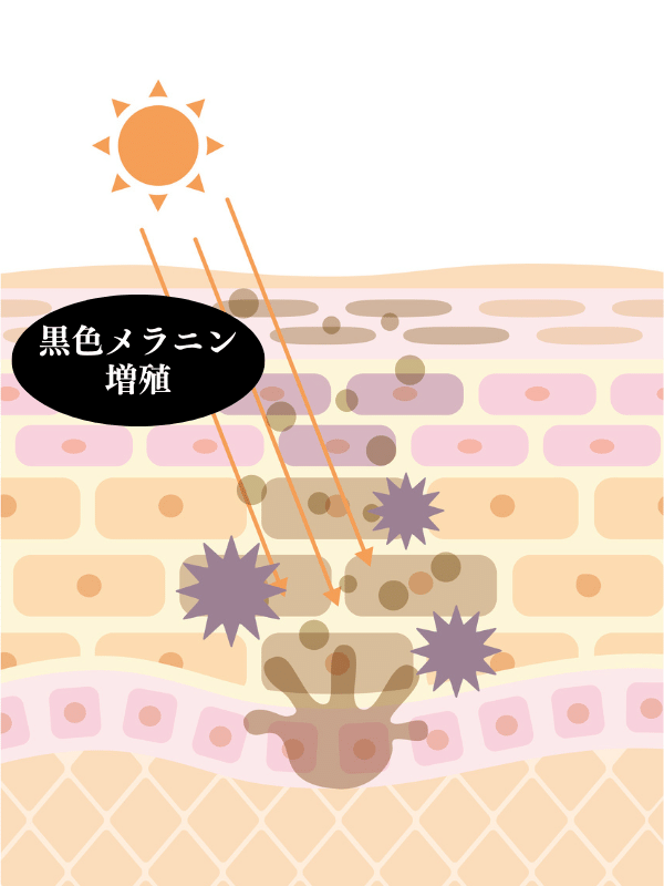 黒色メラニンの増殖
