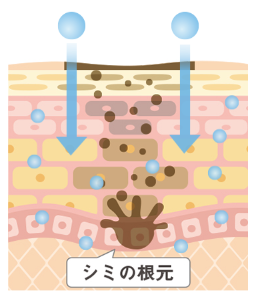 隠れシミの原因